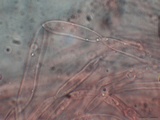 Ascocoryne cylichnium image