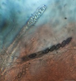 Ascocoryne cylichnium image