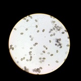 Coprinopsis canoceps image