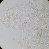 Meottomyces dissimulans image