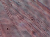 Dacrymyces stillatus image