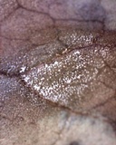 Ramularia rubella image