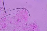 Hyphoderma probatum image