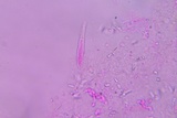 Hyphoderma probatum image