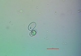 Aspicilia glaucopsina image