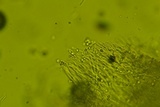 Sidera lenis image