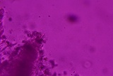 Sidera lenis image