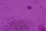 Sidera lenis image