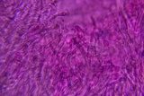Sidera lenis image
