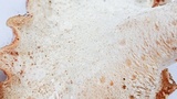 Osteina obducta image