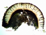 Diploschistes scruposus image