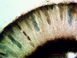Diploschistes scruposus image