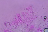 Radulomyces confluens image