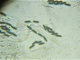 Trichodelitschia munkii image