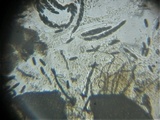 Trichodelitschia munkii image