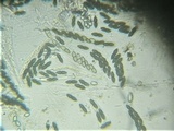 Trichodelitschia munkii image