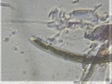 Trichodelitschia munkii image