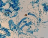 Cyclaneusma minus image