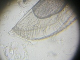 Entomophthora muscae image
