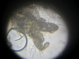 Entomophthora muscae image