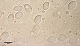 Amanita gioiosa image