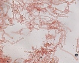 Hemimycena cephalotricha image