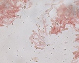 Hemimycena cephalotricha image