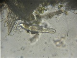 Sporormiella teretispora image