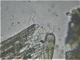 Sporormiella teretispora image