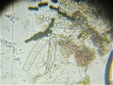 Sporormiella teretispora image