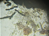 Sporormiella teretispora image