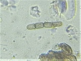 Sporormiella teretispora image