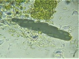 Sporormiella teretispora image