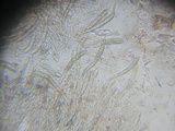 Arachnopeziza obtusipila image