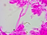 Athelia bombacina image