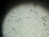Bilimbia sabuletorum image
