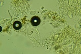 Eichleriella macrospora image