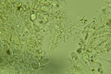 Eichleriella macrospora image