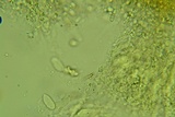 Eichleriella macrospora image