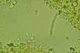 Eichleriella macrospora image