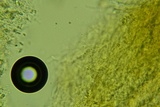 Eichleriella macrospora image