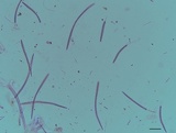 Cyclaneusma minus image