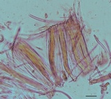 Cyclaneusma minus image