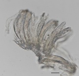 Cyclaneusma minus image
