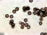 Badhamia panicea image