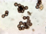 Badhamia panicea image
