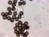 Badhamia panicea image