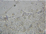 Myxarium nucleatum image